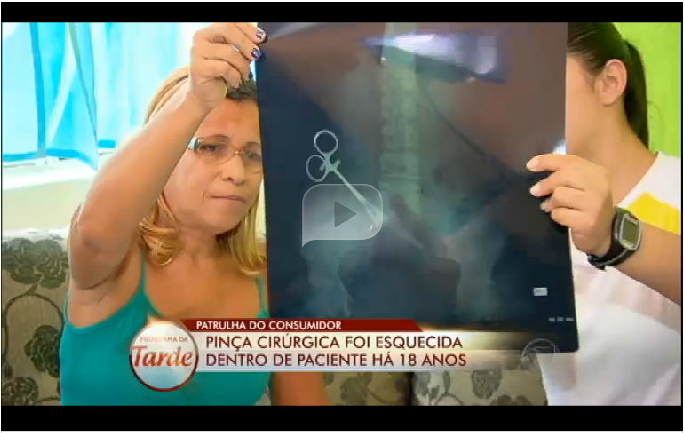 Radiografia mostra pinça esquecida após cirurgia no baço há 18 anos em Maria de Lourdes Dias | Foto: Reprodução do Portal R7